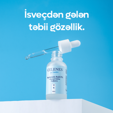İsveçdən gələn təbii gözəllik